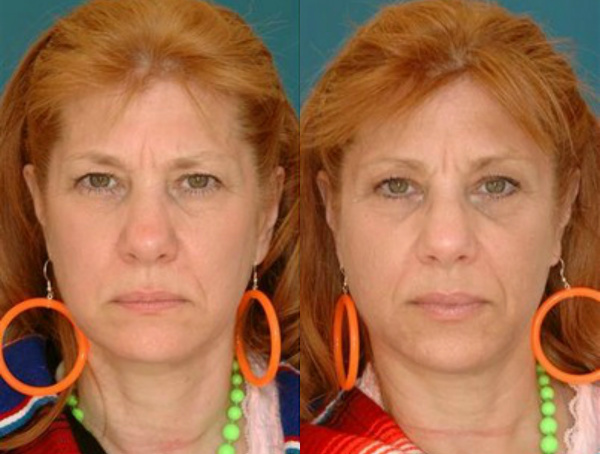 how-does-smoking-age-the-faces-of-identical-twins-287944161-nov-12-2013-1-600x454