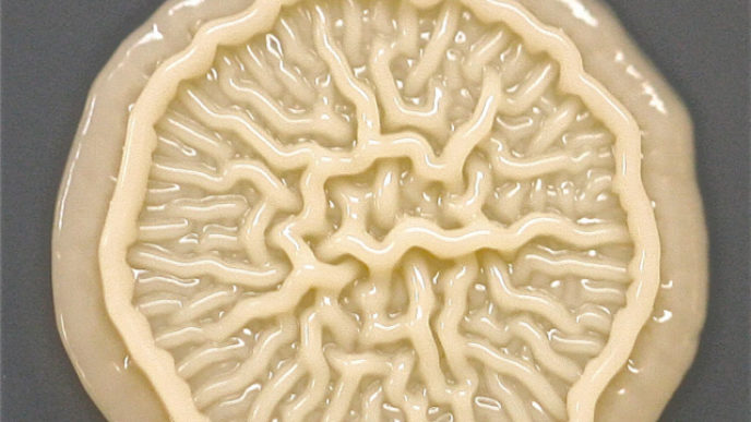 bacteria-petri-dish-microbe-8-year-old-boy-hand-print-tasha-sturm-3