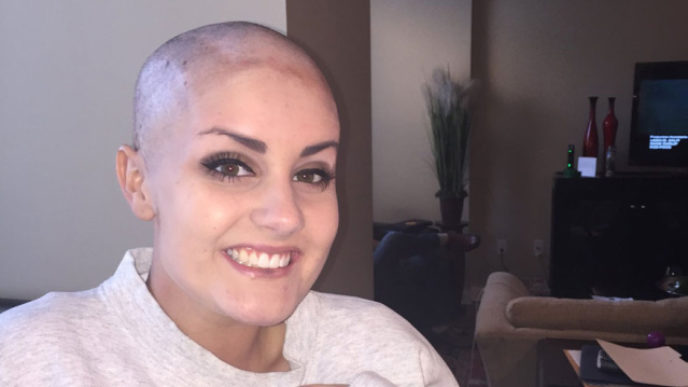 Brain cancer allie allen shaved head brayden carpenter homecoming 3.jpg