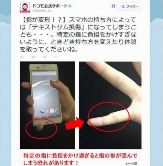 This is what happens to your pinky if you are holding your smartphone like this 1.jpg