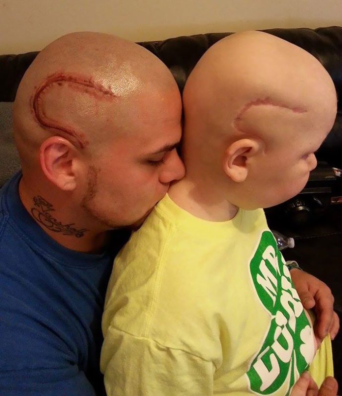 Cancer tattoo scar son father josh mash marshall 5.jpg