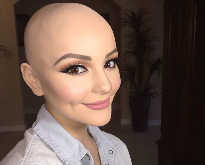 Bald teen cancer photoshoot andrea sierra salazar gerardo garmendia 40.jpg