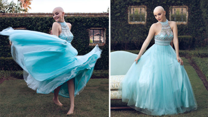 Bald teen cancer photoshoot andrea sierra salazar gerardo garmendia 42.jpg