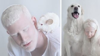 Porcelain beauty a project featuring albino people fb3__700 png.jpg