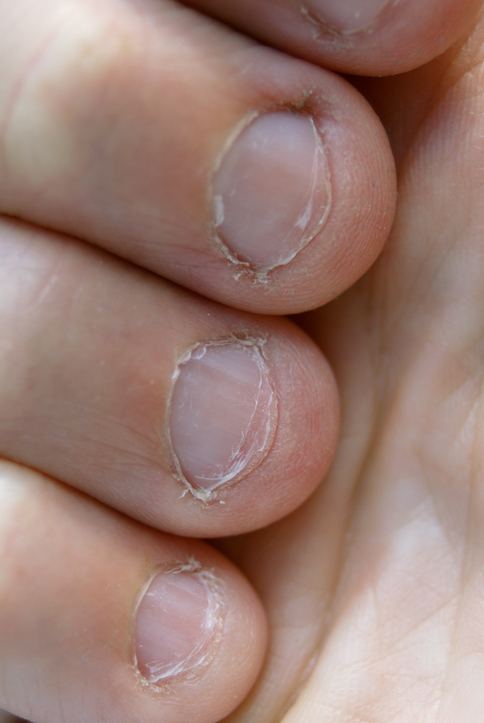 http://www.thinkstockphotos.com/search/#chewing nails/f=CPIHVX/s=DynamicRank