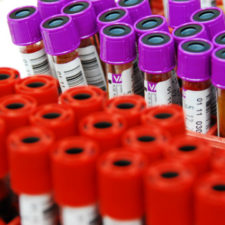 Blood samples in blood bank
