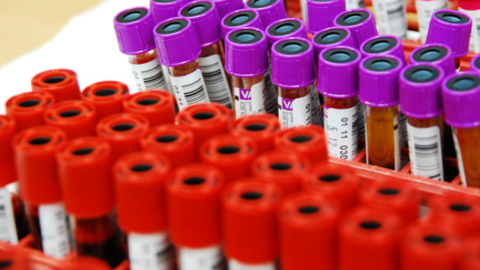 Blood samples in blood bank