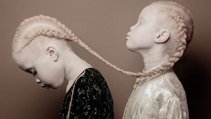 Albino twins models 10 58e74b0f6915c__880 1.jpg