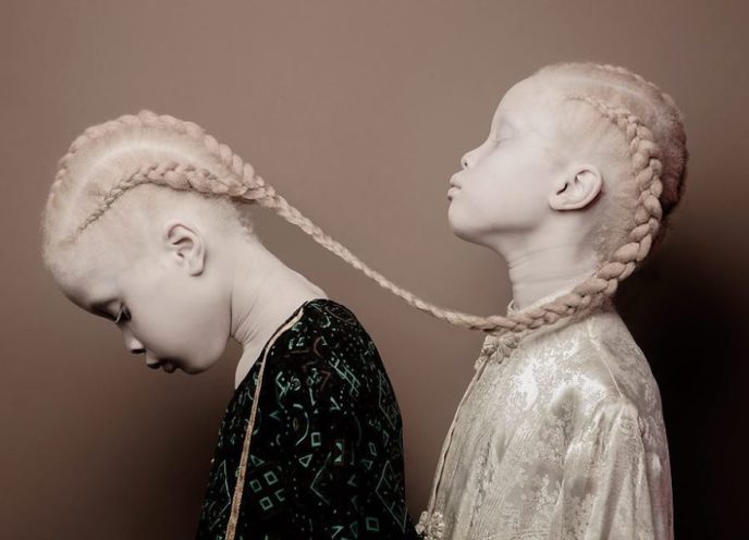 Albino twins models 10 58e74b0f6915c__880 1.jpg