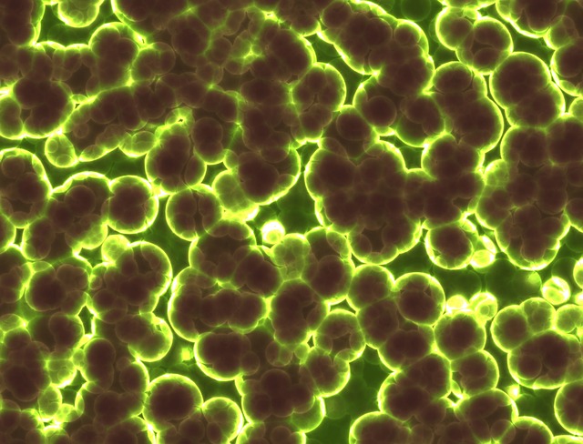 Bacteria 1959386_640.jpg