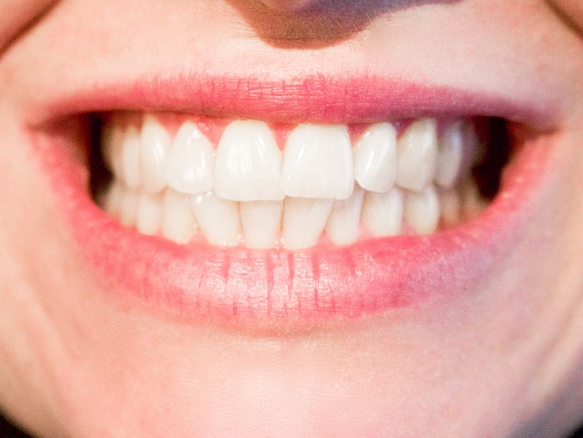 Teeth 1652976_640.jpg