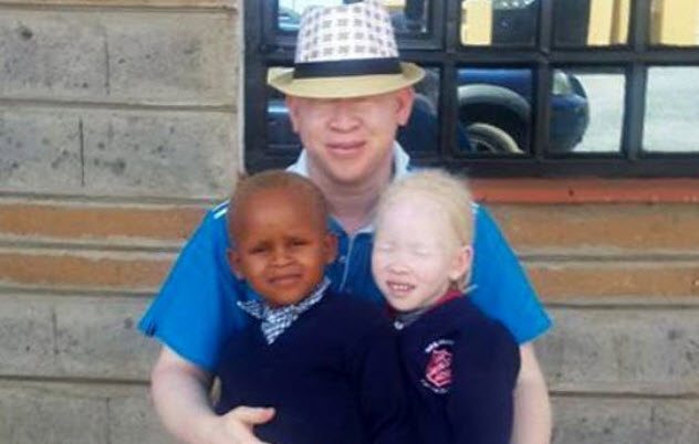2a albinos who almost died tanzanian killers.jpg