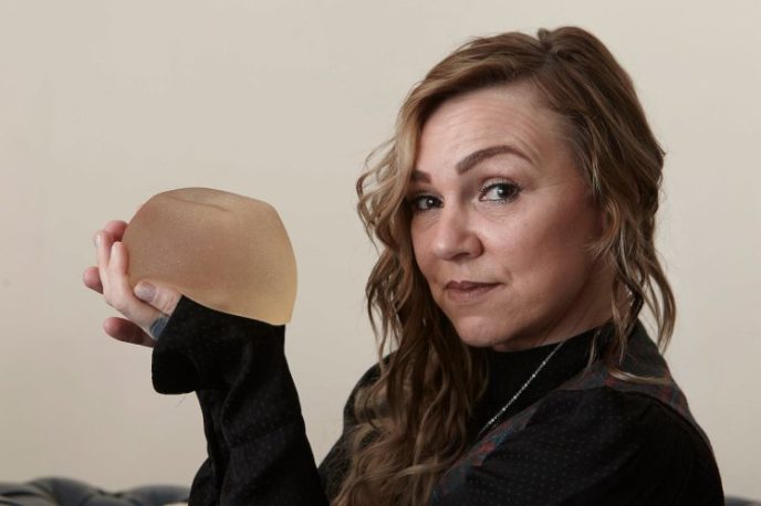MUM REMOVES HER OWN BREAST IMPLANT