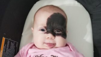Baby is born with a mark on her face and the parents call her superhero for remembering the mask of batman 5af4e2809bf2d__605.jpg