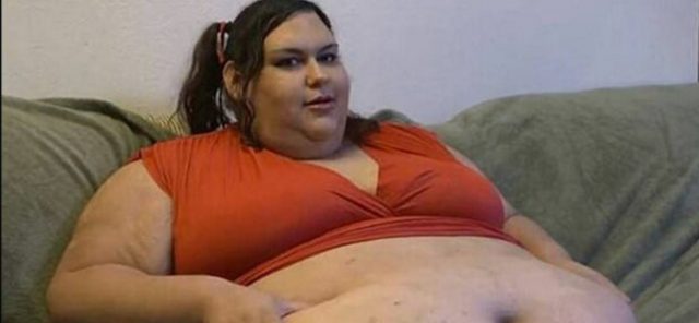 obézna žena