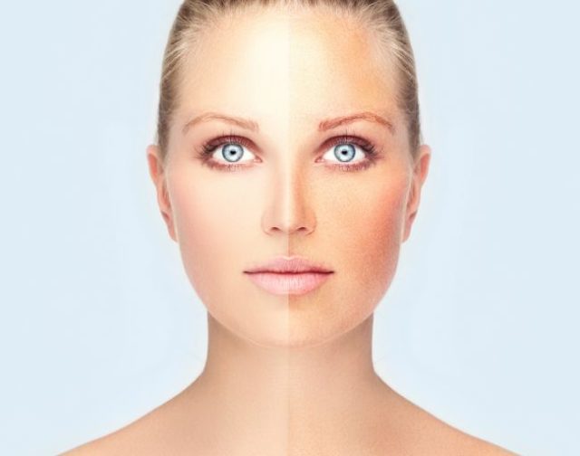 Tvár ženy-polovica opálená, druhá polovica bez opálenia