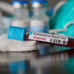 Koronavirus testy nitrianska nemocnica GettyImages