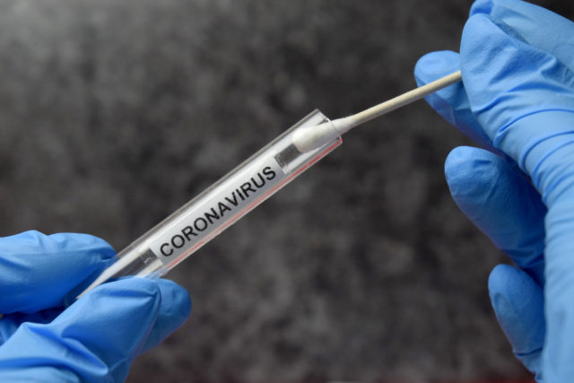 koronavirus testovanie