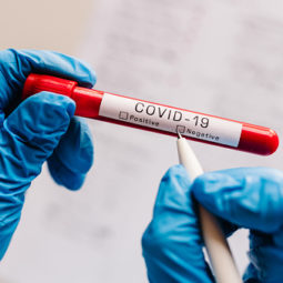 Testovacie odberné miesta na koronavírus v Nitre