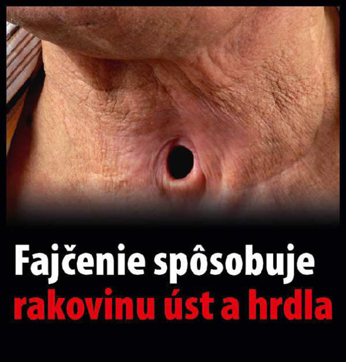 VLÁDA: Varovné obrázky na cigaretách