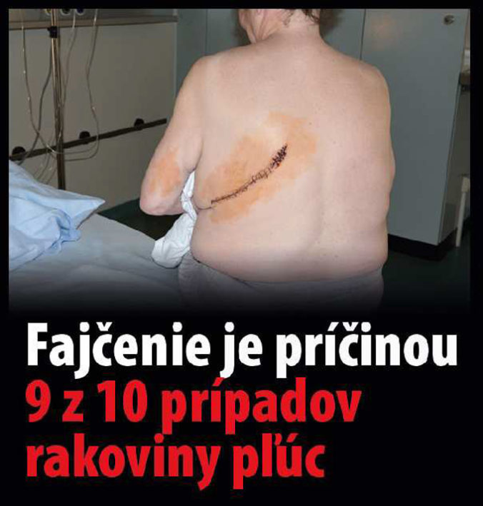 VLÁDA: Varovné obrázky na cigaretách