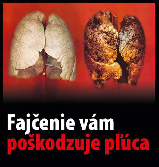 VLÁDA: Varovné obrázky na cigaretách