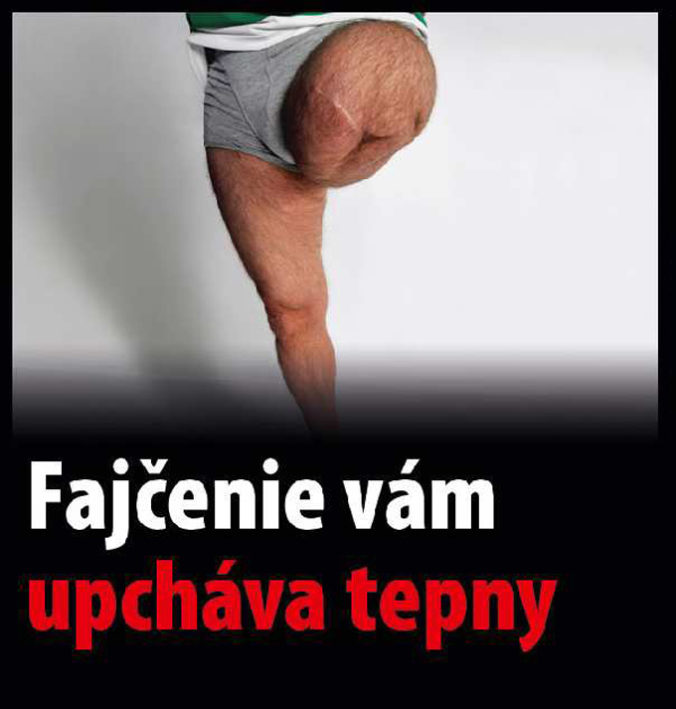 VLÁDA: Varovné obrázky na cigaretách