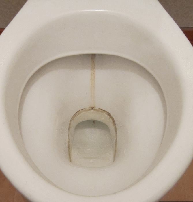 Toilet bowl before small.gif