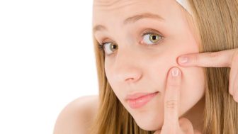 2 acne.jpg