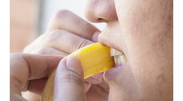 Whitening teeth by using banana peels.jpg