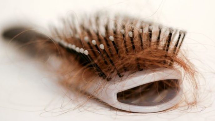 Gty_hair_thinning_jef_140722_16x9_608.jpg