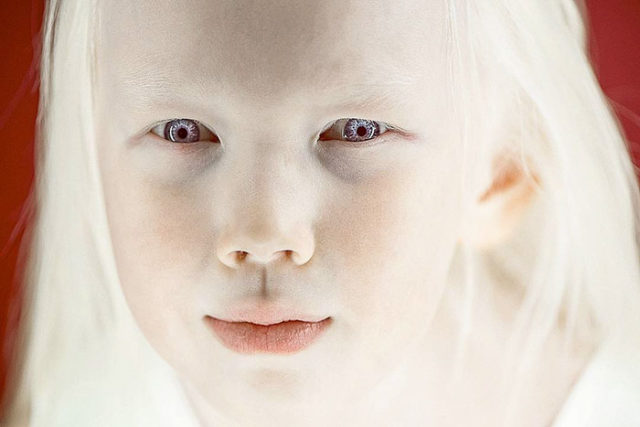 Albino girl snow white nariyana siberia 5.jpg