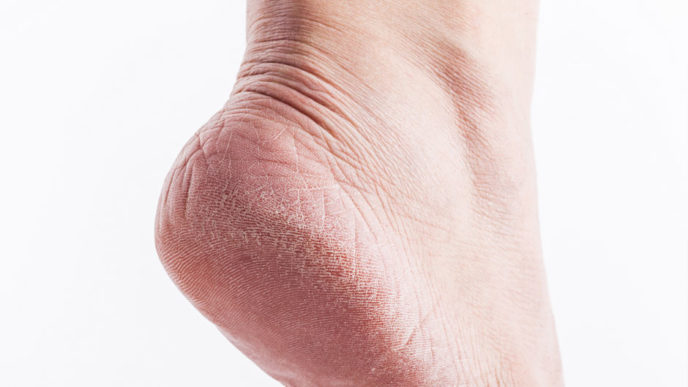 Dryheels.jpg