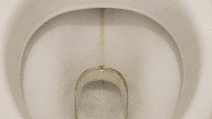 Toilet bowl before small.gif