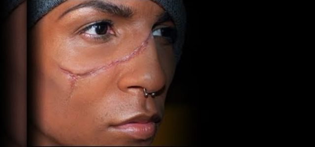 Create fake scars for halloween using rigid collodion.1280x600.jpg