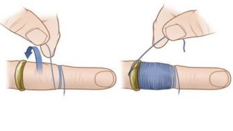 How to get a stubborn ring off your finger.jpg