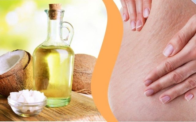 Remove stretch marks with coconut oil salve.jpg