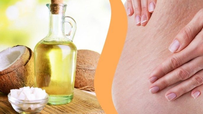 Remove stretch marks with coconut oil salve.jpg