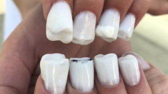 Molar teeth nail art 3 5af5412b3adb7__700.jpg