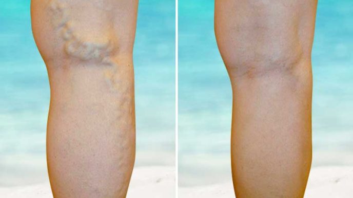 Before after web.jpg