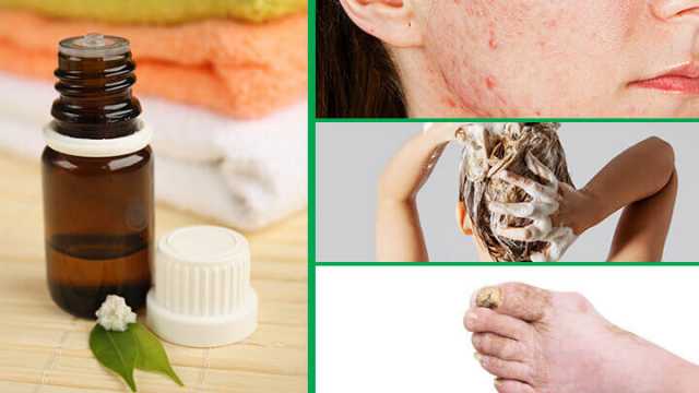 Tea tree oil benefits and how to use it 640x360.jpg