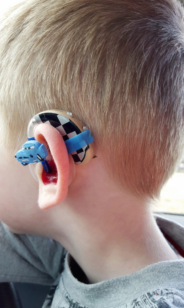 Lugs disney cars hearing aids cochlear implants.jpg
