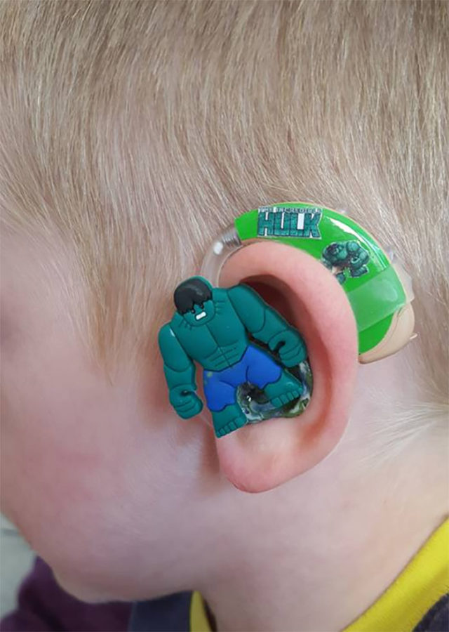 The hulk hearing aid.jpg