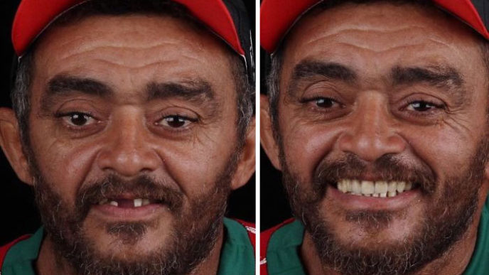 Brazilian dentist travel poor people teeth fix felipe rossi 33 5db94fa3b7aee__700.jpg