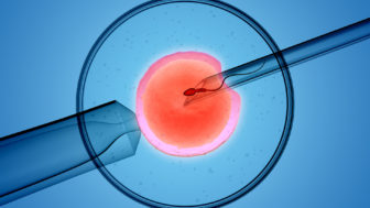3D rendering of the icsi(intracytoplasmic sperm injection) process - in which a single sperm is injected directly into an egg