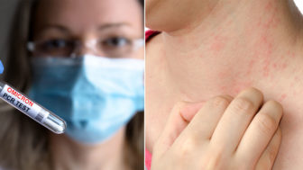 Omikron to nie je len kašeľ