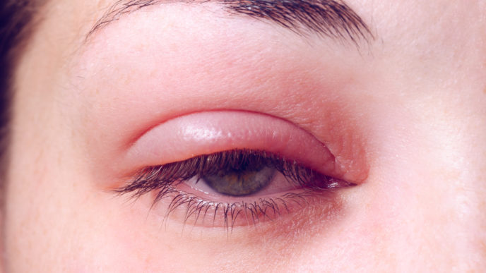 Eye