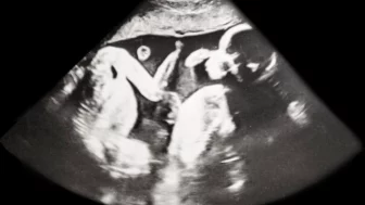 manžel takmer omdlel