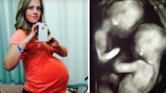 uvideli ultrazvuk, zostali vystrašení!