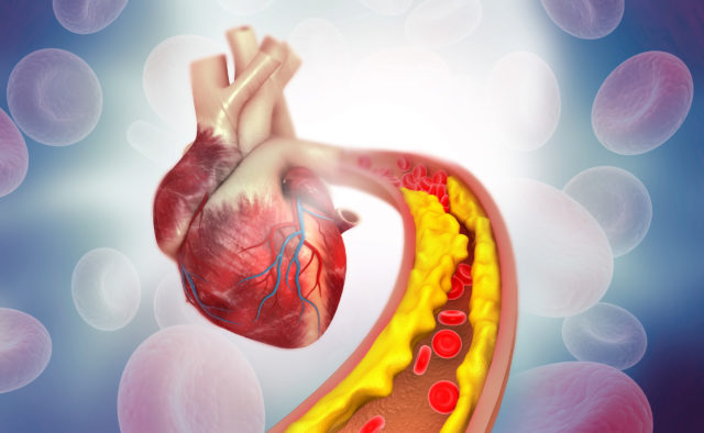 nepriatelia nebezpečného cholesterolu